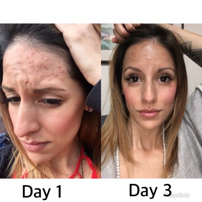 Photos of Renu Dermatology and Wellness Fullerton, CA