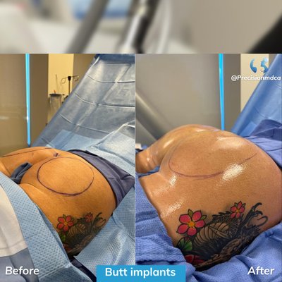 Photos of Precision M.D. Cosmetic Surgery Center Sacramento, CA