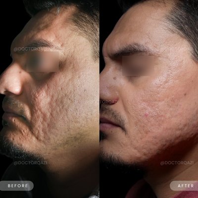 Photos of Qazi Cosmetic Clinic Santa Ana, CA