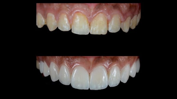 Photos of Agoura Advanced Dentistry Ventura, CA