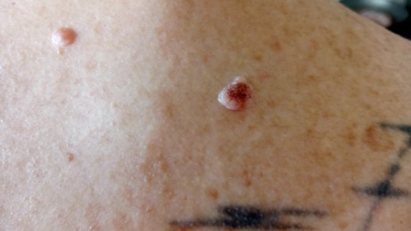 Photos of Steven E Hodgkin, MD Victorville, CA