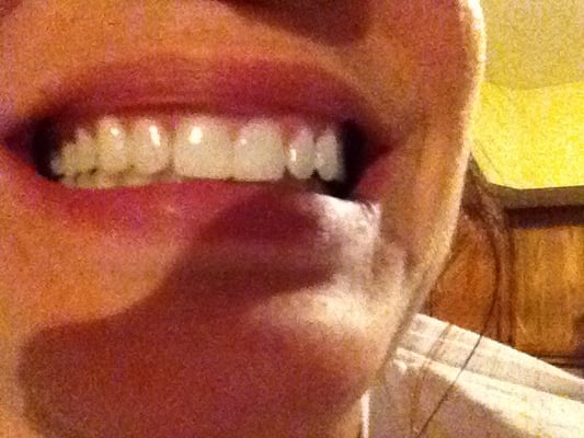 Photos of Admired Smiles Dental Center Bourne, MA
