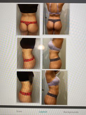 Photos of Forever Slender MedSpa Bourne, MA