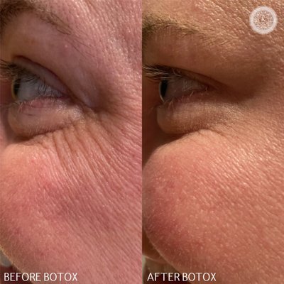 Photos of KYMA anti-aging center Bourne, MA
