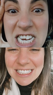 Photos of Unique Smile Dental Associates Bourne, MA