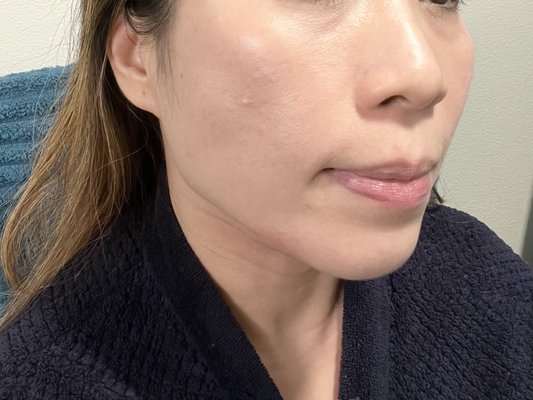 Photos of Bellevue Laser and Cosmetic Center Seattle, WA