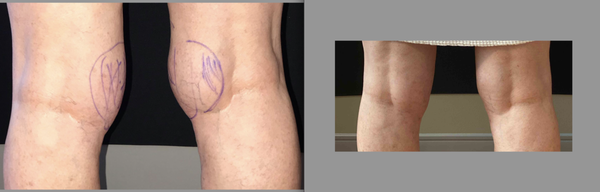 Photos of Mountcastle Plastic Surgery and Vein Institute Charles Town, WV
