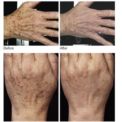 Photos of Infinity Skin Care Belmont, WI